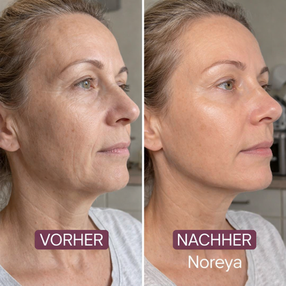 Kollagen-Maske für erschlaffte Halshaut