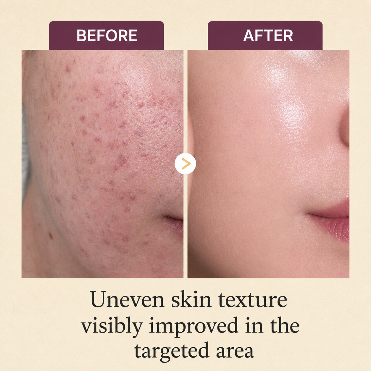 Kojic Acid Turmeric Overnight Mask