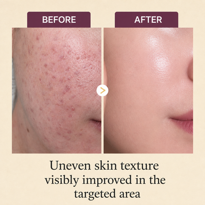 Kojic Acid Turmeric Overnight Mask