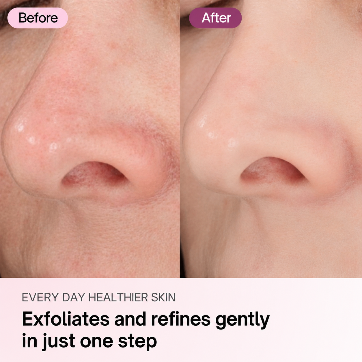 Zero Pore Pads