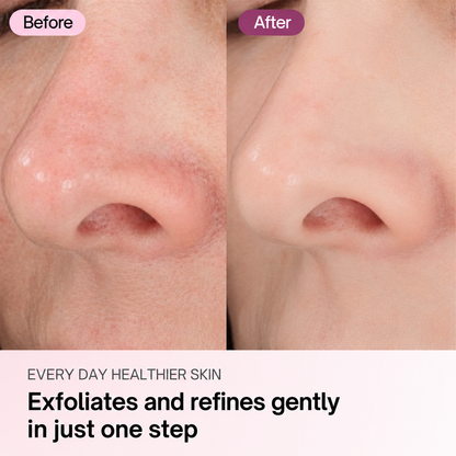 Zero Pore Pads