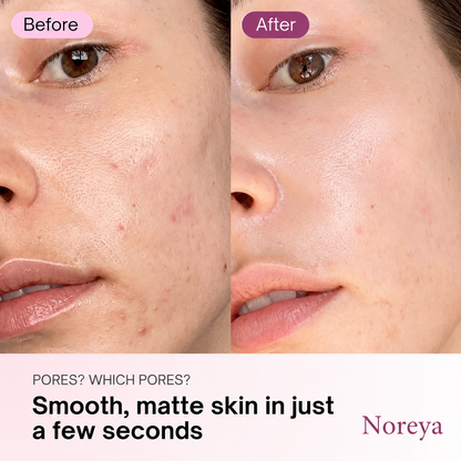 Zero Pore Pads